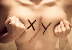 Día de la visibildiad Intersexual: contra la patologización